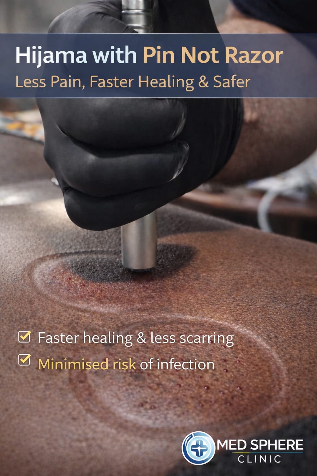 Professional Hijama Treatment